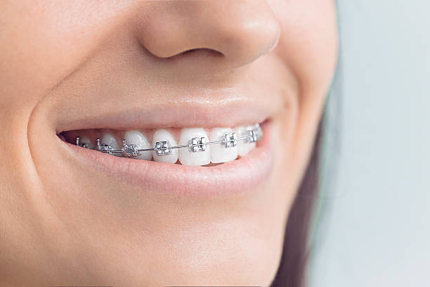 Best Traditional Braces  in Gatlinburg, TN